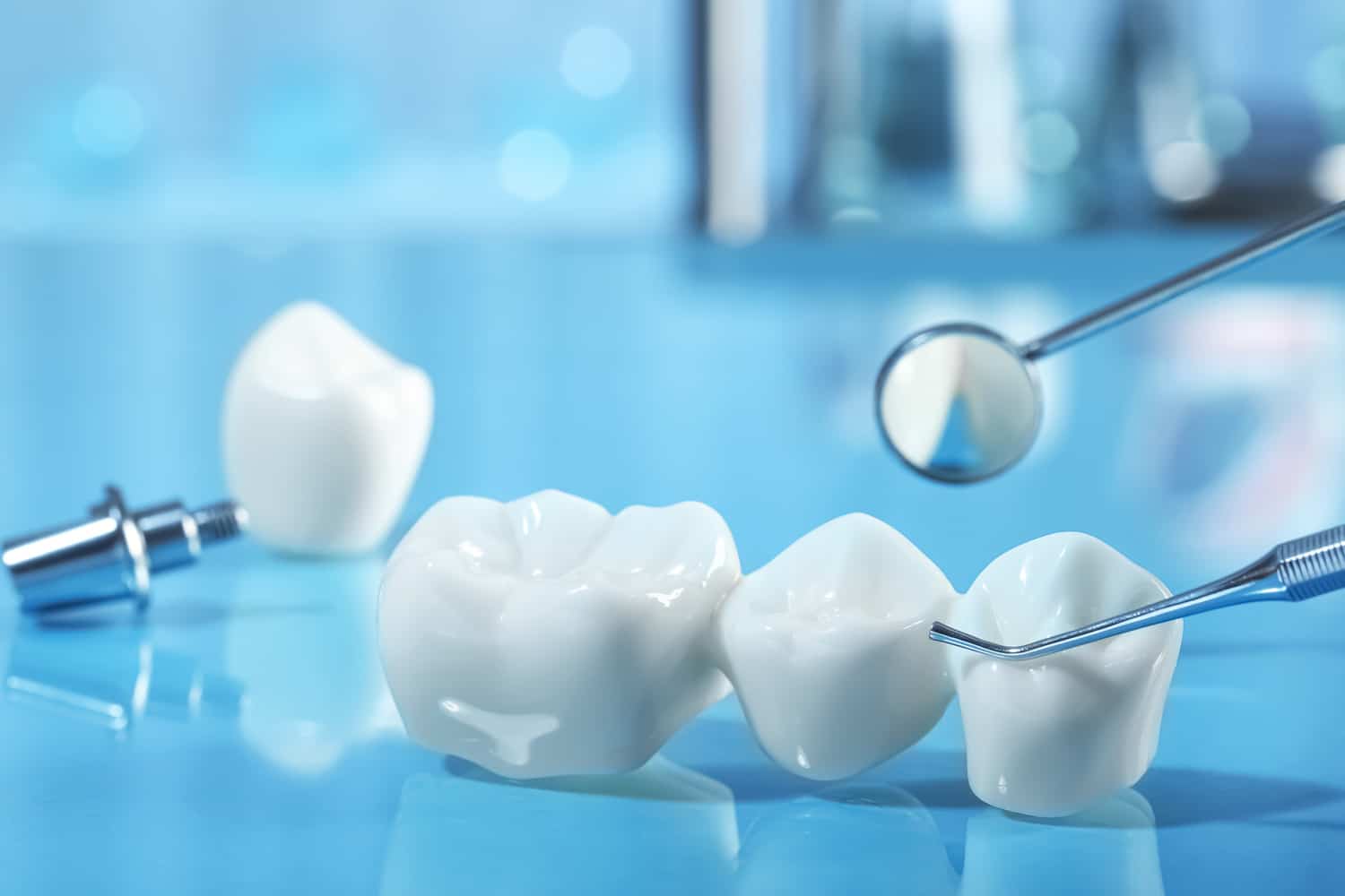 A dental bridge at Renovo Prosthodontics in Salt Lake City